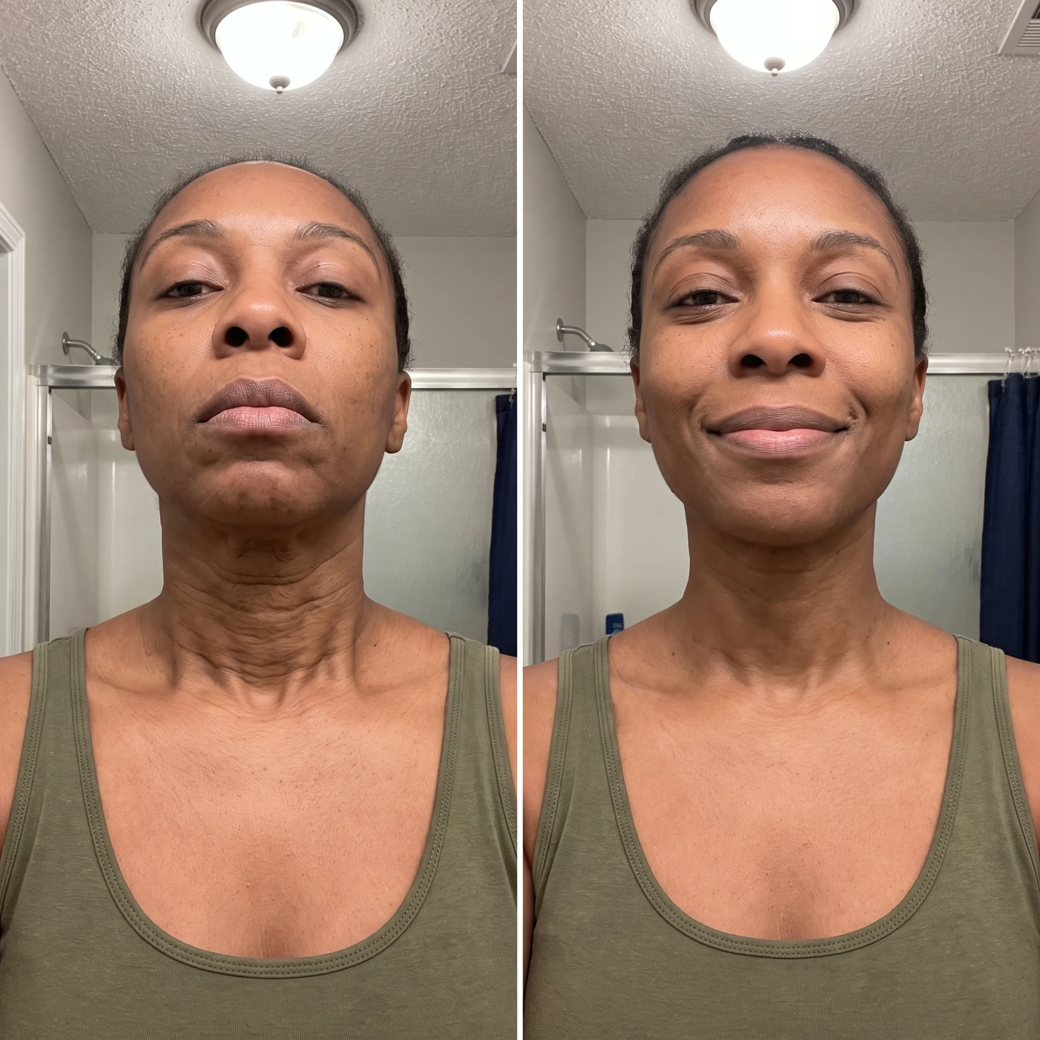 Keyla M. before and after