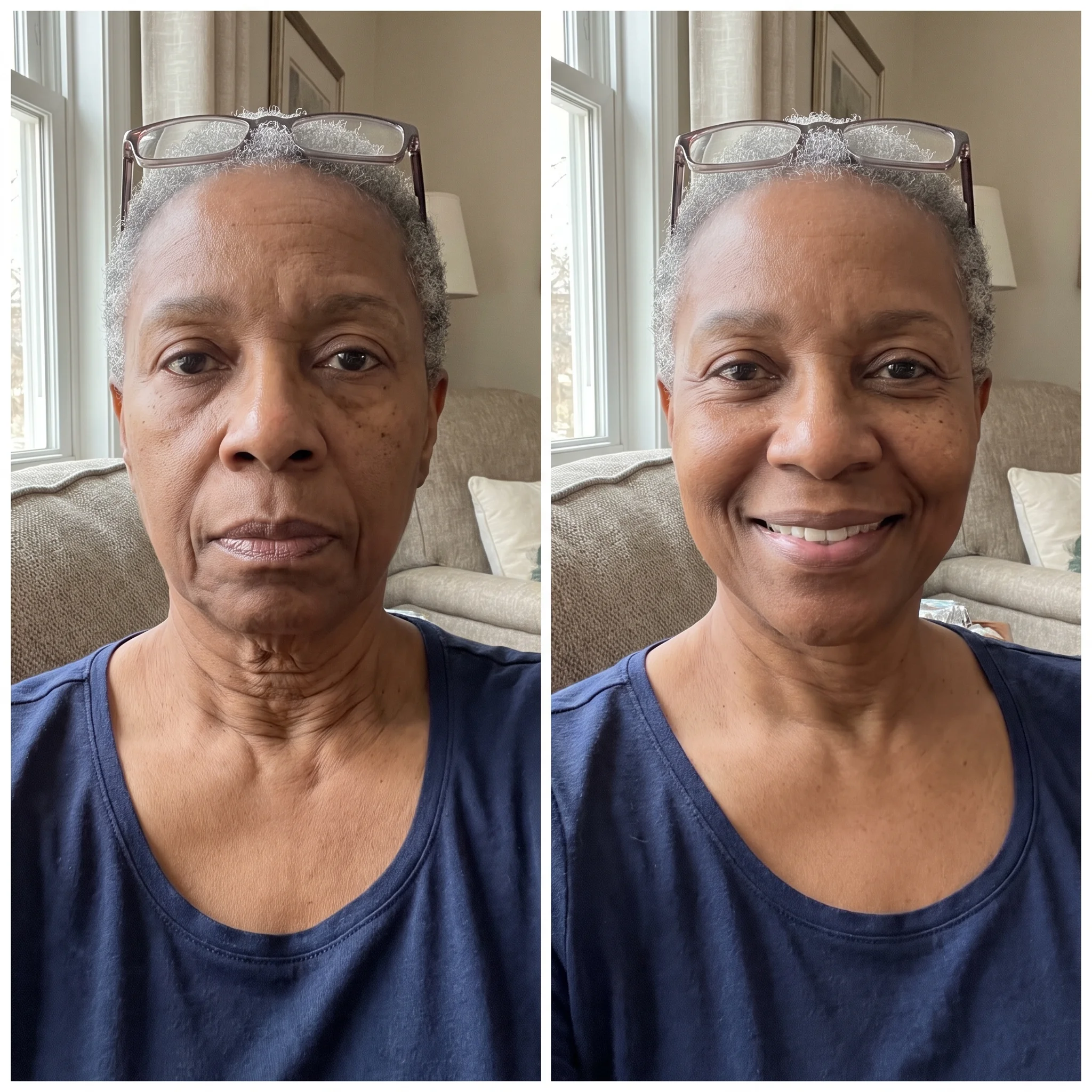 Danielle W. before and after